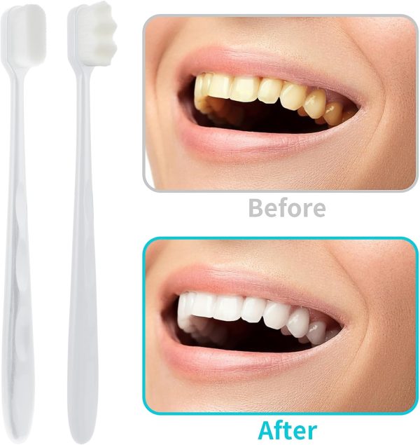Soft Tooth Brush – Micro Nano Tooth Brush For Sensitive Gums